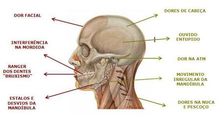 Dores Orofaciais e Desordens da ATM