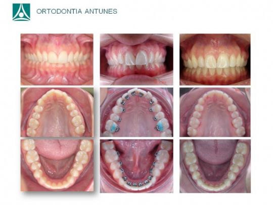 Conheça as instalações da Ortodontia Antunes