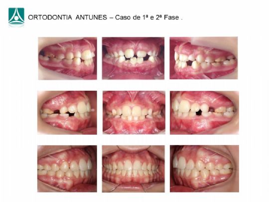 Conheça as instalações da Ortodontia Antunes