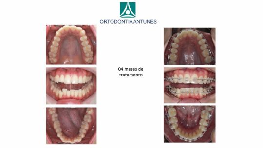 Conheça as instalações da Ortodontia Antunes