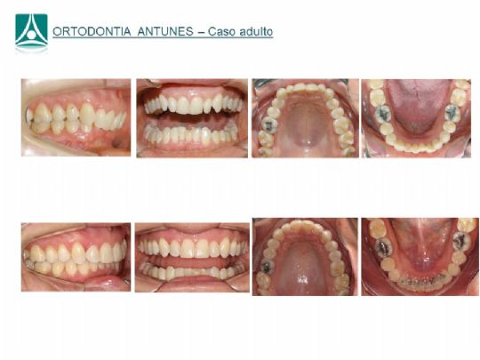 Conheça as instalações da Ortodontia Antunes