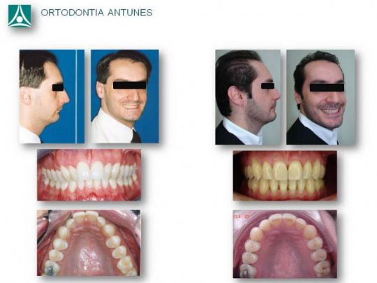 Conheça as instalações da Ortodontia Antunes