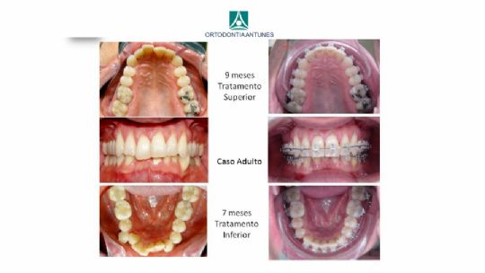 Conheça as instalações da Ortodontia Antunes
