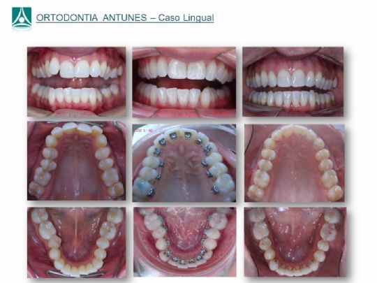 Conheça as instalações da Ortodontia Antunes