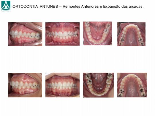 Conheça as instalações da Ortodontia Antunes