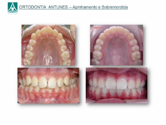 Conheça as instalações da Ortodontia Antunes
