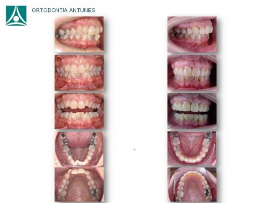 Conheça as instalações da Ortodontia Antunes