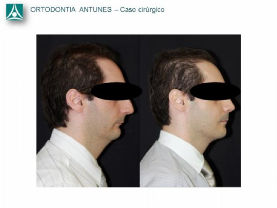 Conheça as instalações da Ortodontia Antunes