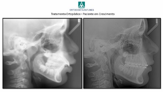 Conheça as instalações da Ortodontia Antunes