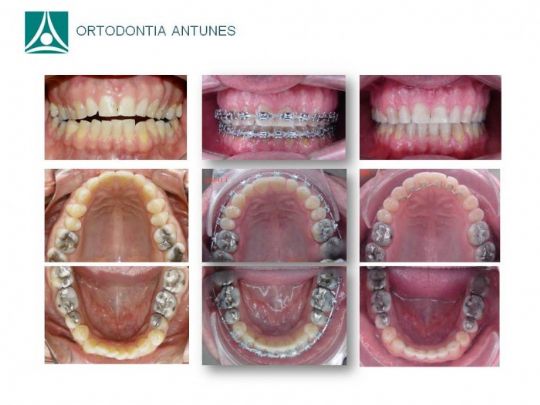 Conheça as instalações da Ortodontia Antunes