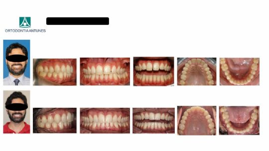 Conheça as instalações da Ortodontia Antunes