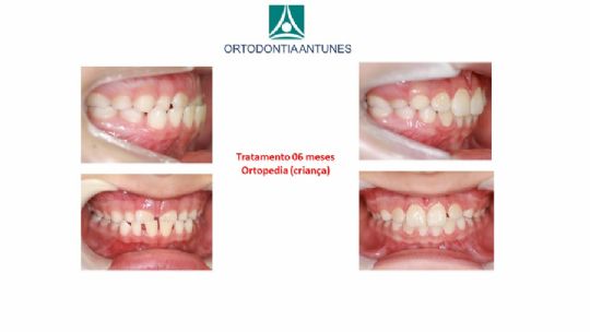 Conheça as instalações da Ortodontia Antunes