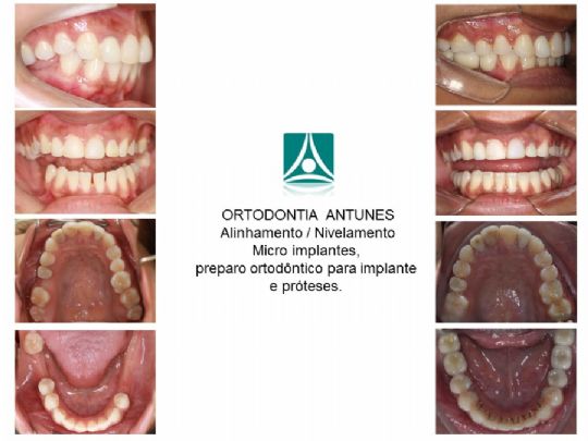 Conheça as instalações da Ortodontia Antunes