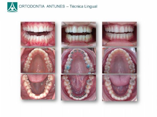 Conheça as instalações da Ortodontia Antunes