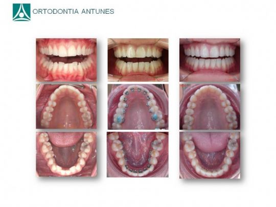 Conheça as instalações da Ortodontia Antunes