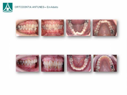 Conheça as instalações da Ortodontia Antunes