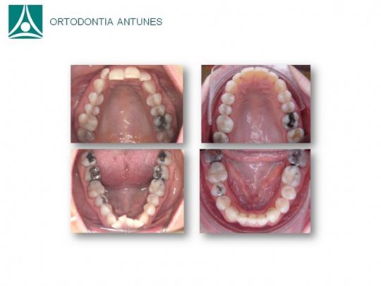 Conheça as instalações da Ortodontia Antunes