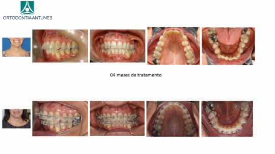Conheça as instalações da Ortodontia Antunes
