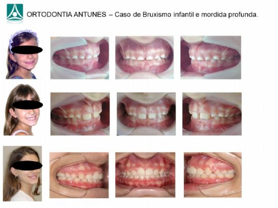 Conheça as instalações da Ortodontia Antunes