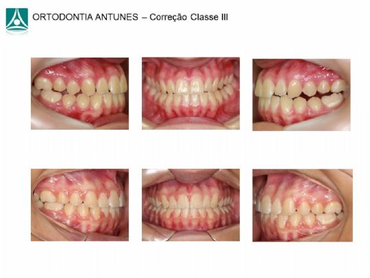 Conheça as instalações da Ortodontia Antunes
