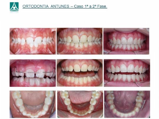 Conheça as instalações da Ortodontia Antunes