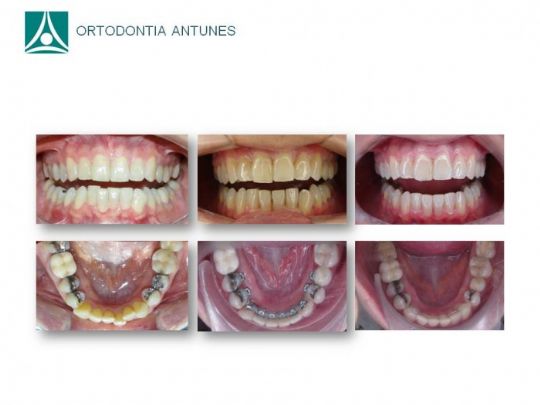 Conheça as instalações da Ortodontia Antunes